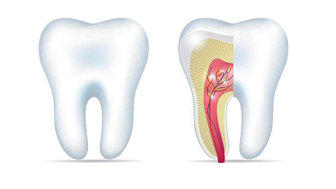 An Umbrella with a Hole Root Canal Therapy Explained Root Canal